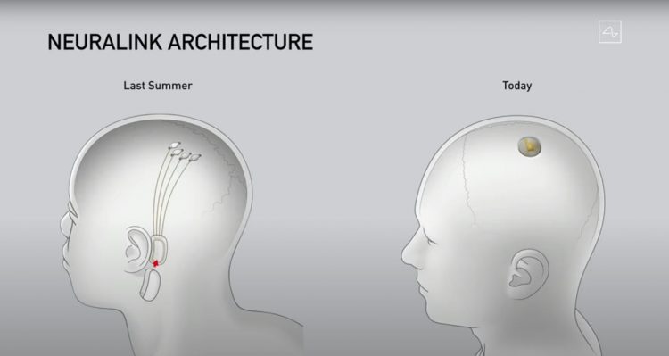 Architektúra Neuralink
