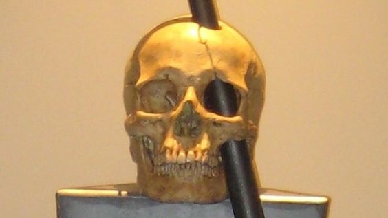 Phineas Gage