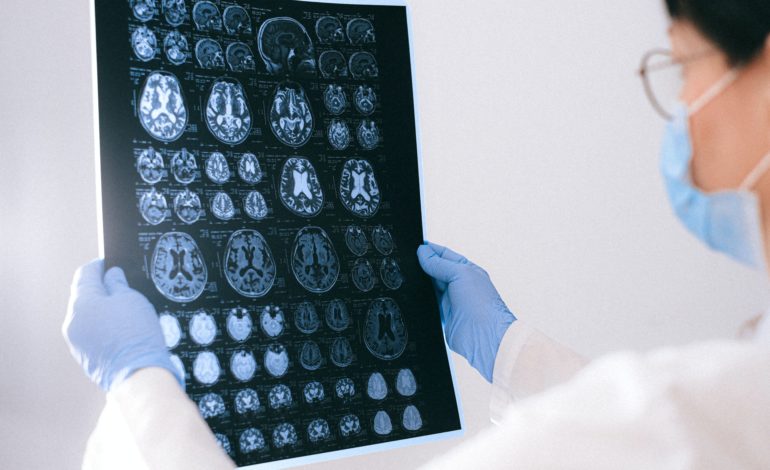 Mozgový implantát prepisujúci myšlienky je nádejou pre paralyzovaných pacientov